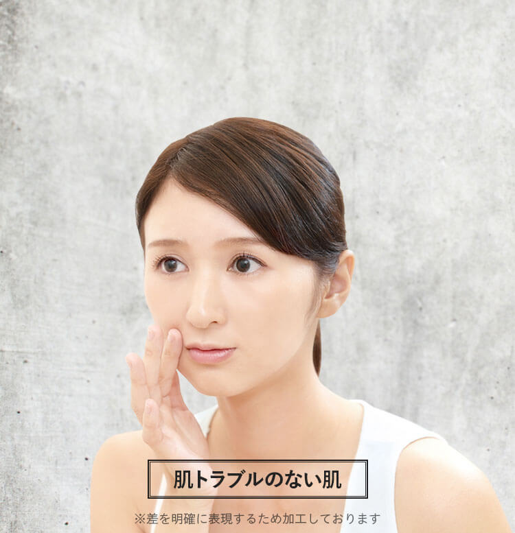 肌トラブルのない肌