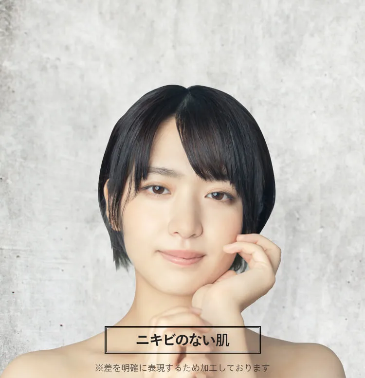 肌トラブルのない肌