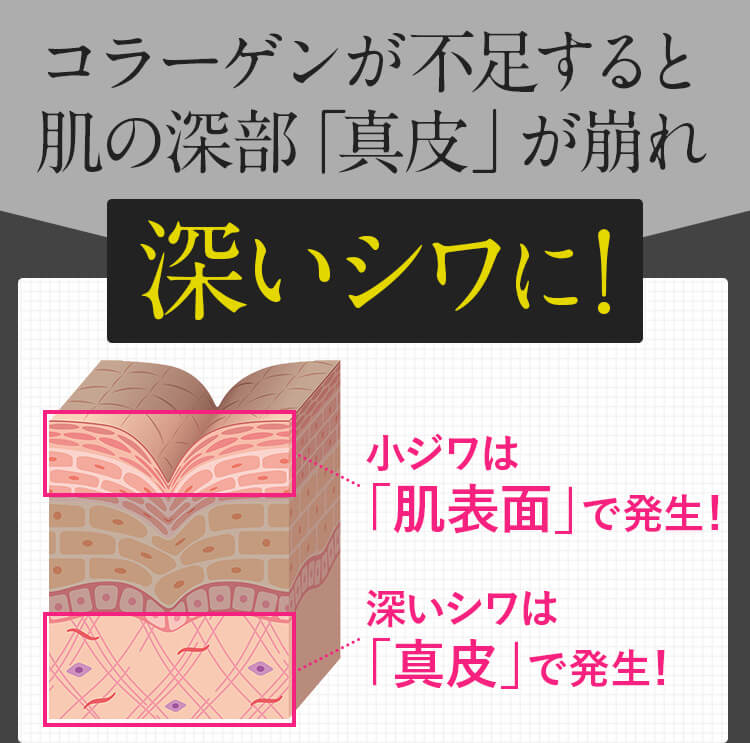 コラーゲンが不足すると深いシワに